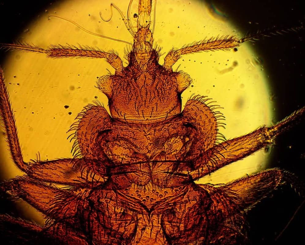 20 Mikroskopische Aufnahme des Bettwanzenkopfes