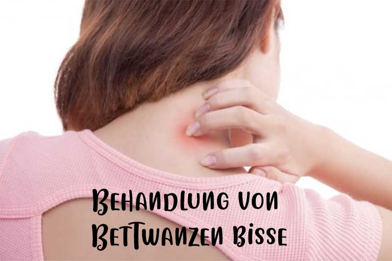 Behandlung von Bettwanzen bisse